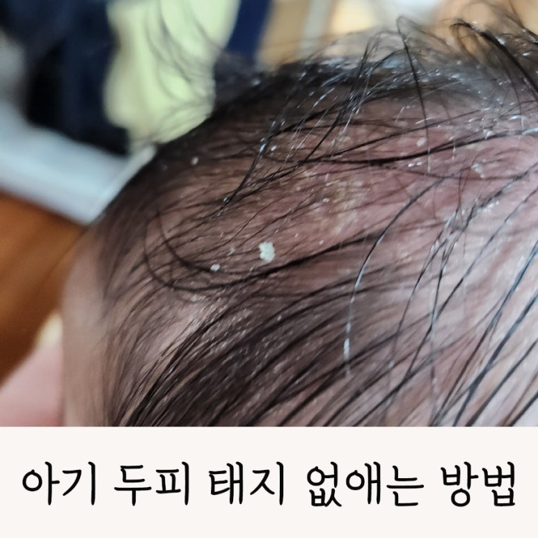 깨끗태진 이미지