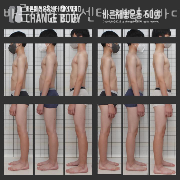 바디체인지체형교정 이미지