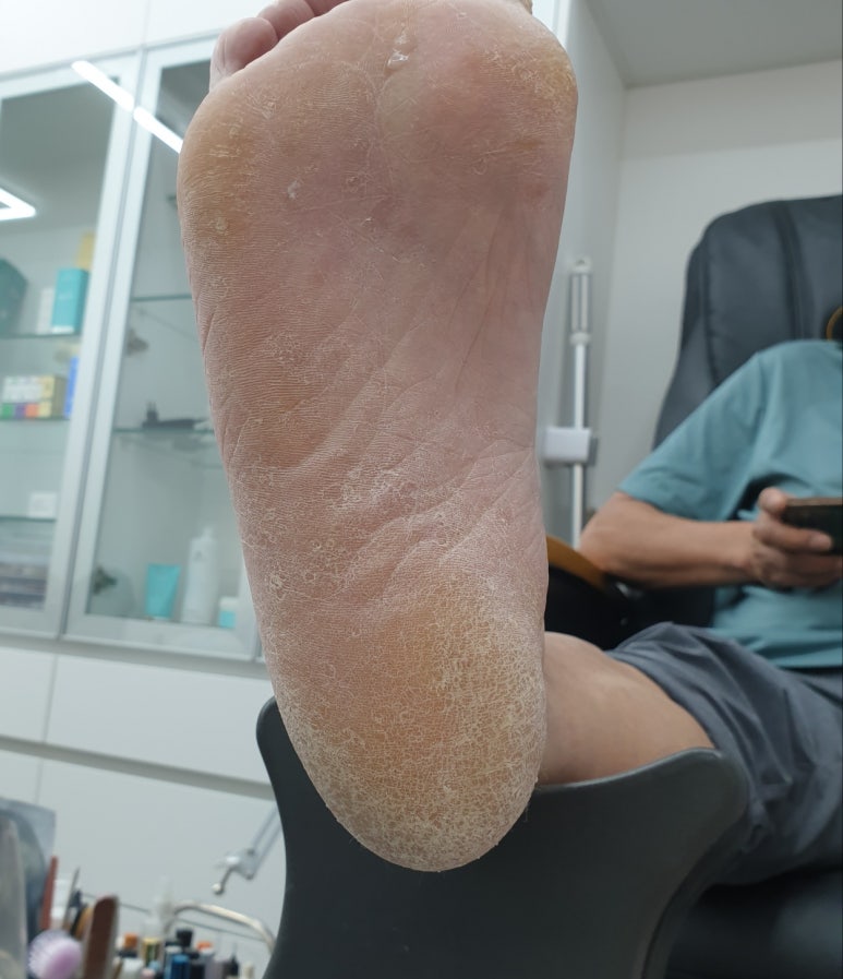 발라발라네일 이미지