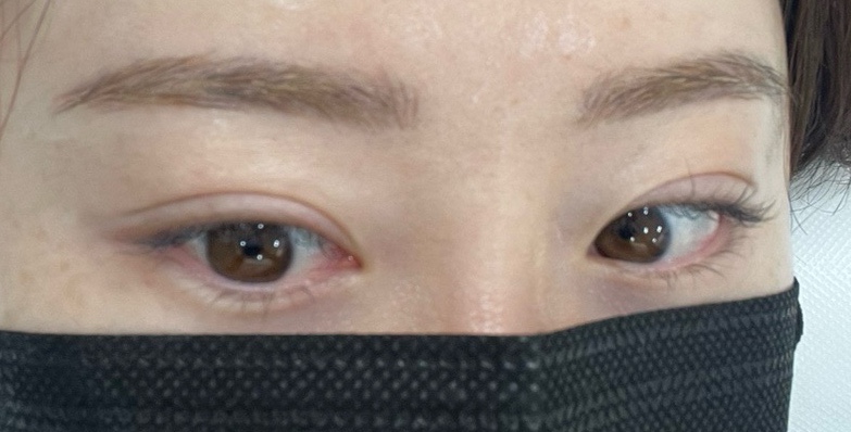 누벨르브로우 이미지