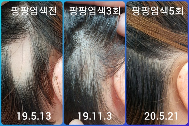 염색팡팡 이미지