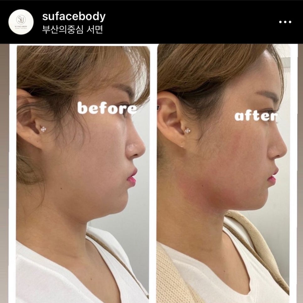 라인피부앤바디 이미지