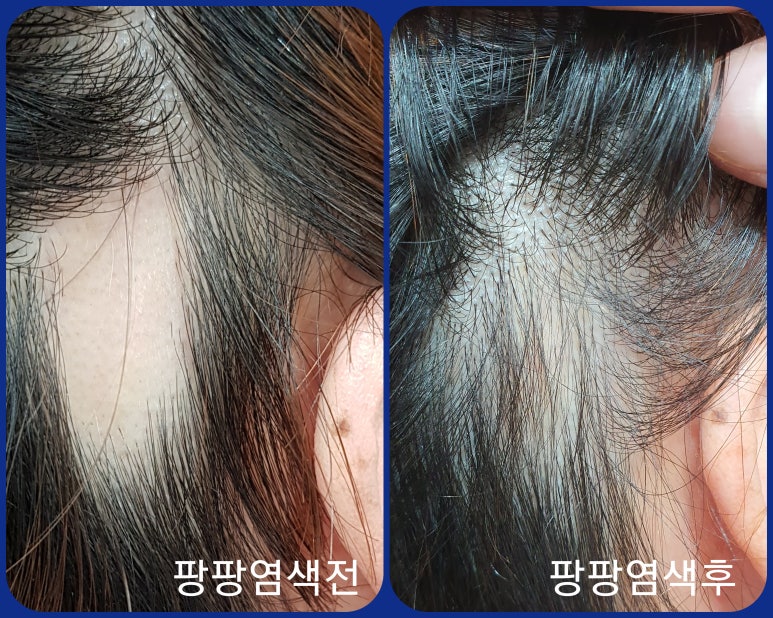 큐사랑머리염색 이미지