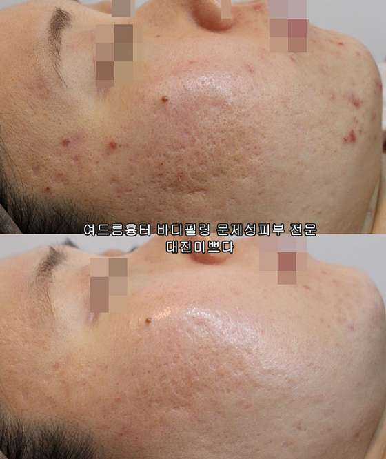 미쁘다피부관리 이미지
