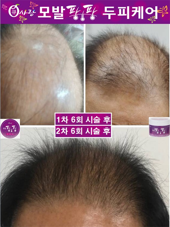 염색팡팡 이미지