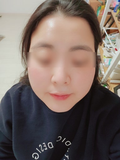피부완정연구소 이미지