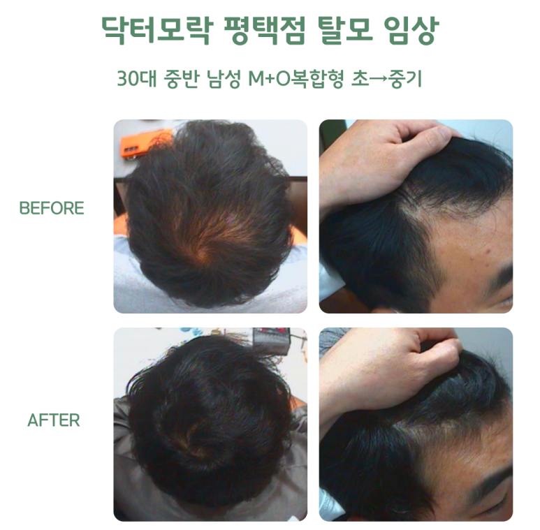 닥터모락 평택점 이미지