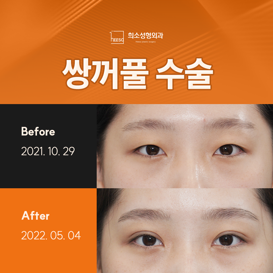 희소성형외과의원 이미지