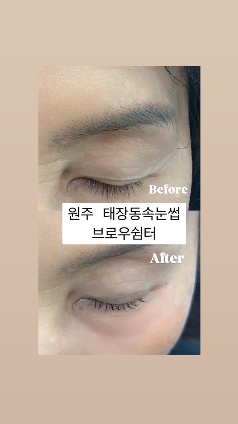 브로우쉼터 이미지