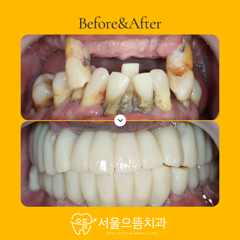 서울으뜸치과의원 이미지