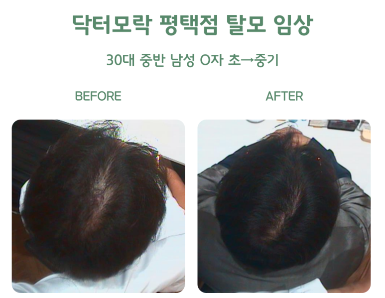 닥터모락 평택점 이미지