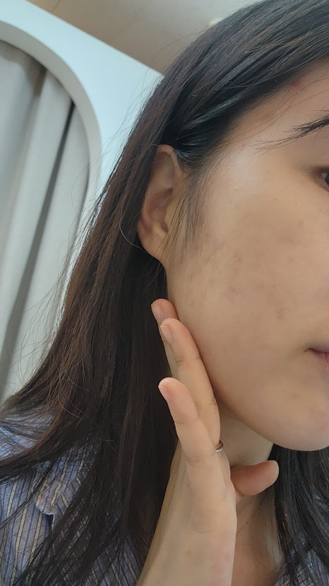 옐로우스킨앤바디 이미지