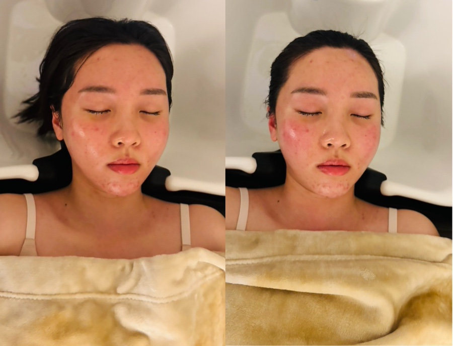하루헤드스파 이미지