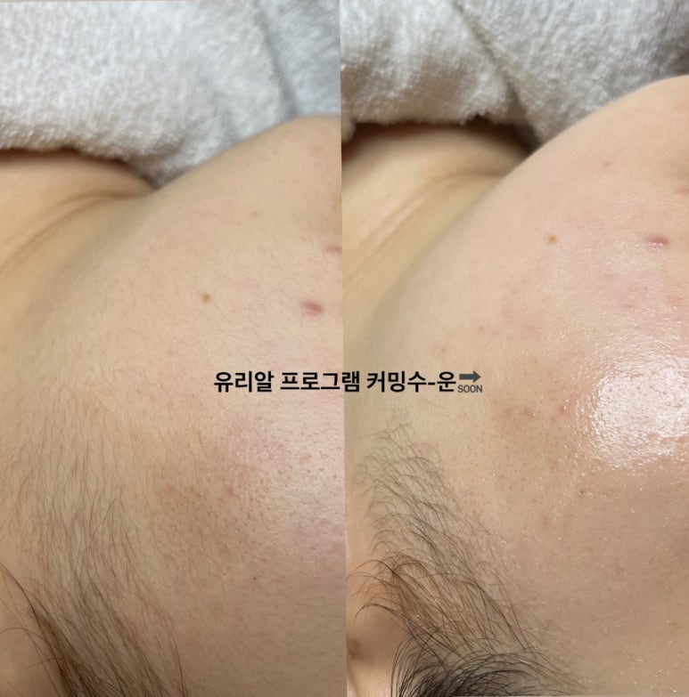 유빛 이미지