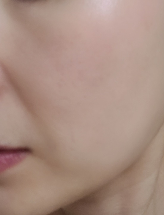 블로즈 이미지