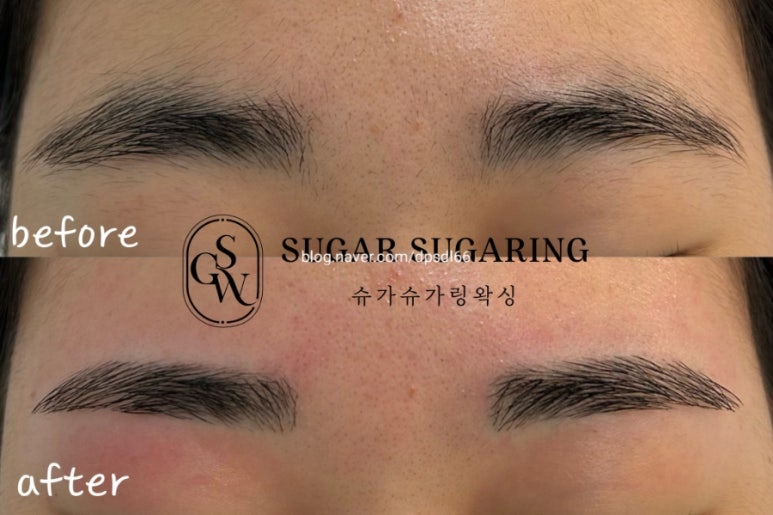 슈가슈가링 이미지