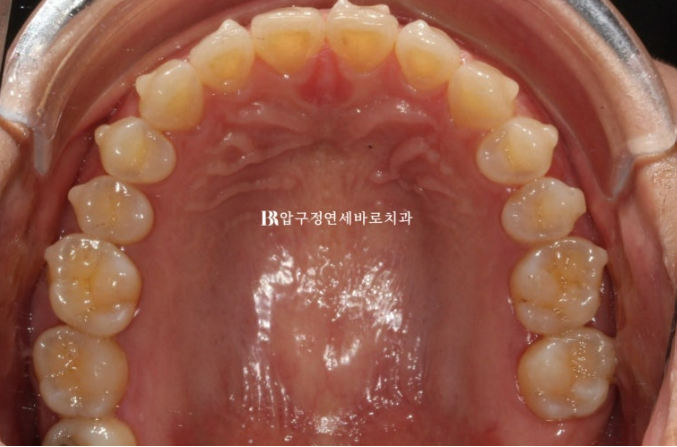 젤라 이미지