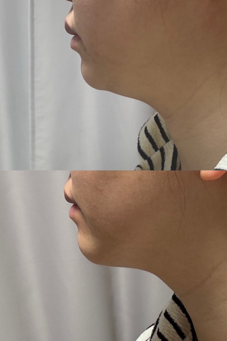 젠틀야채 이미지