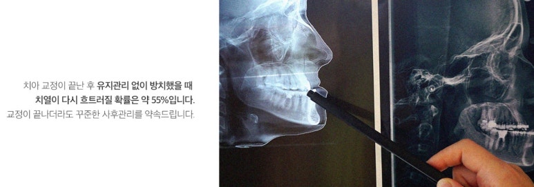 서울하이안치과방배 이미지