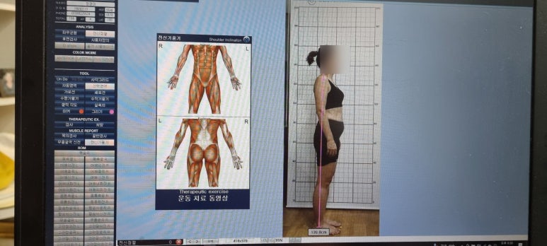 바른체형뷰티샵 이미지