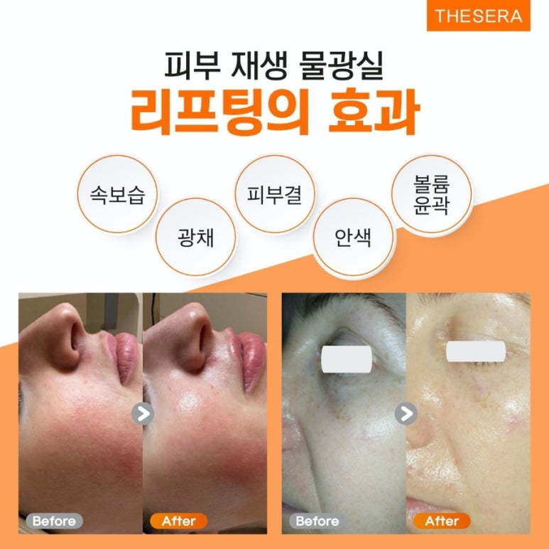 쎄라 이미지