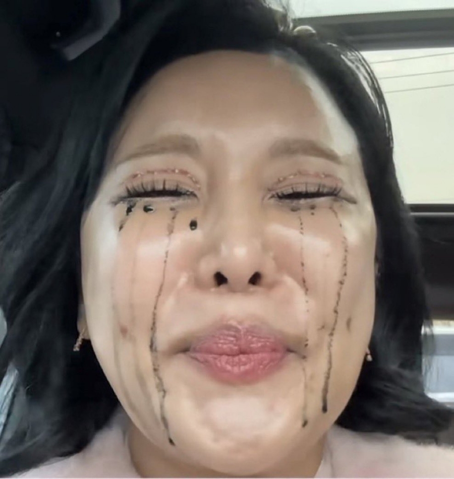 시농 이미지