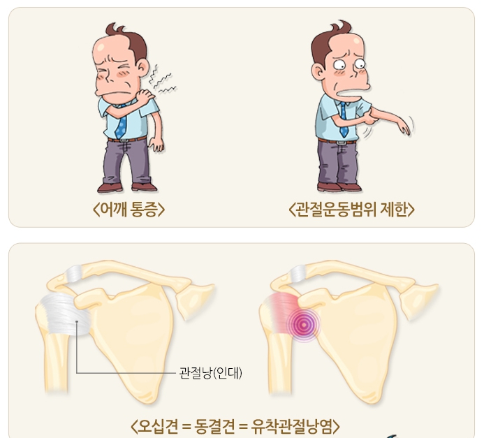 바름관리 이미지