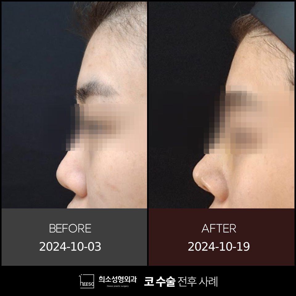 희소성형외과의원 이미지