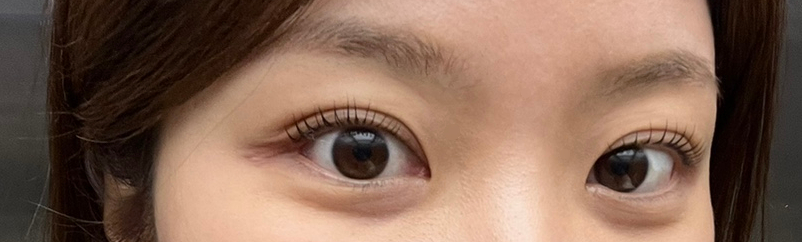 바이레마 이미지