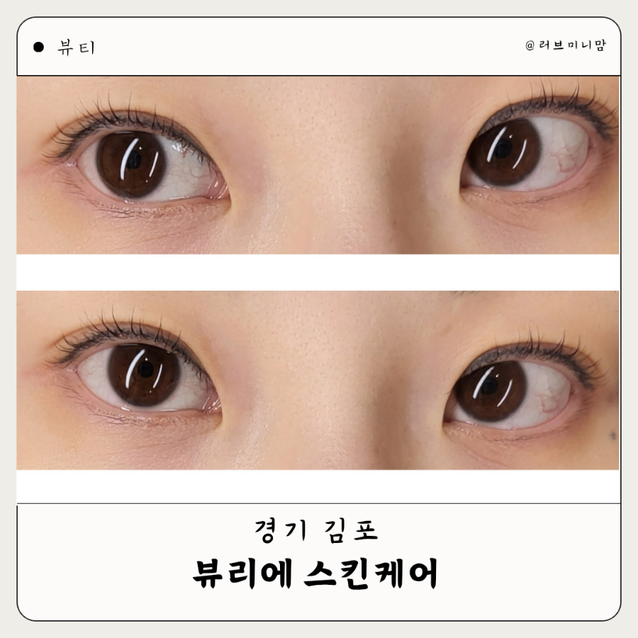 뷰리에스킨케어 이미지
