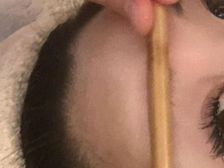루스파 이미지