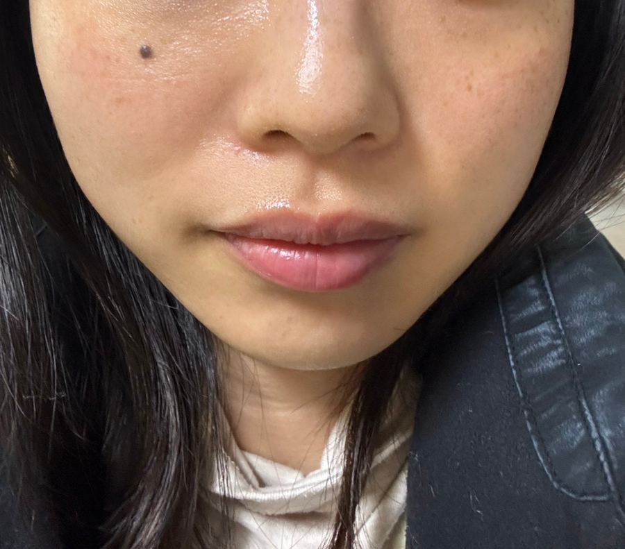 보테에스테틱 이미지