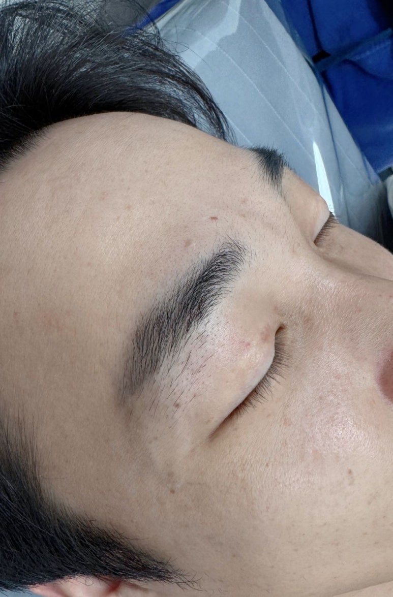 페리투에스테틱 이미지