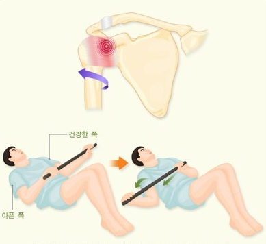 바름관리 이미지