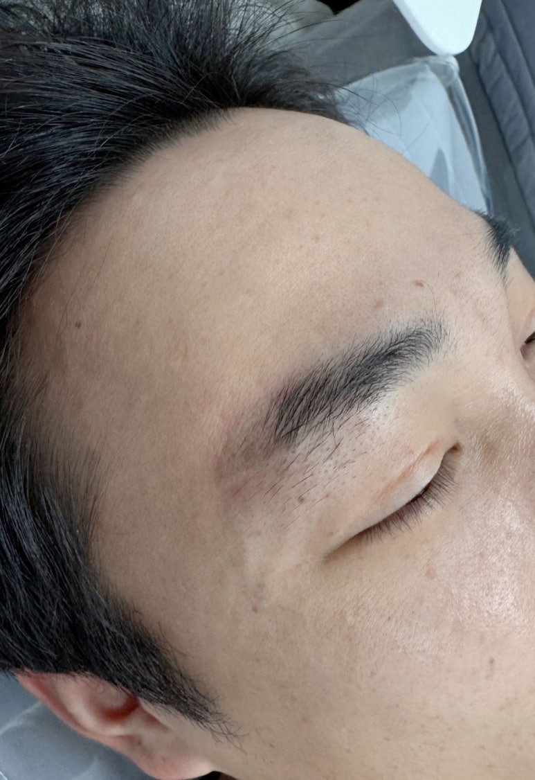 페리투에스테틱 이미지