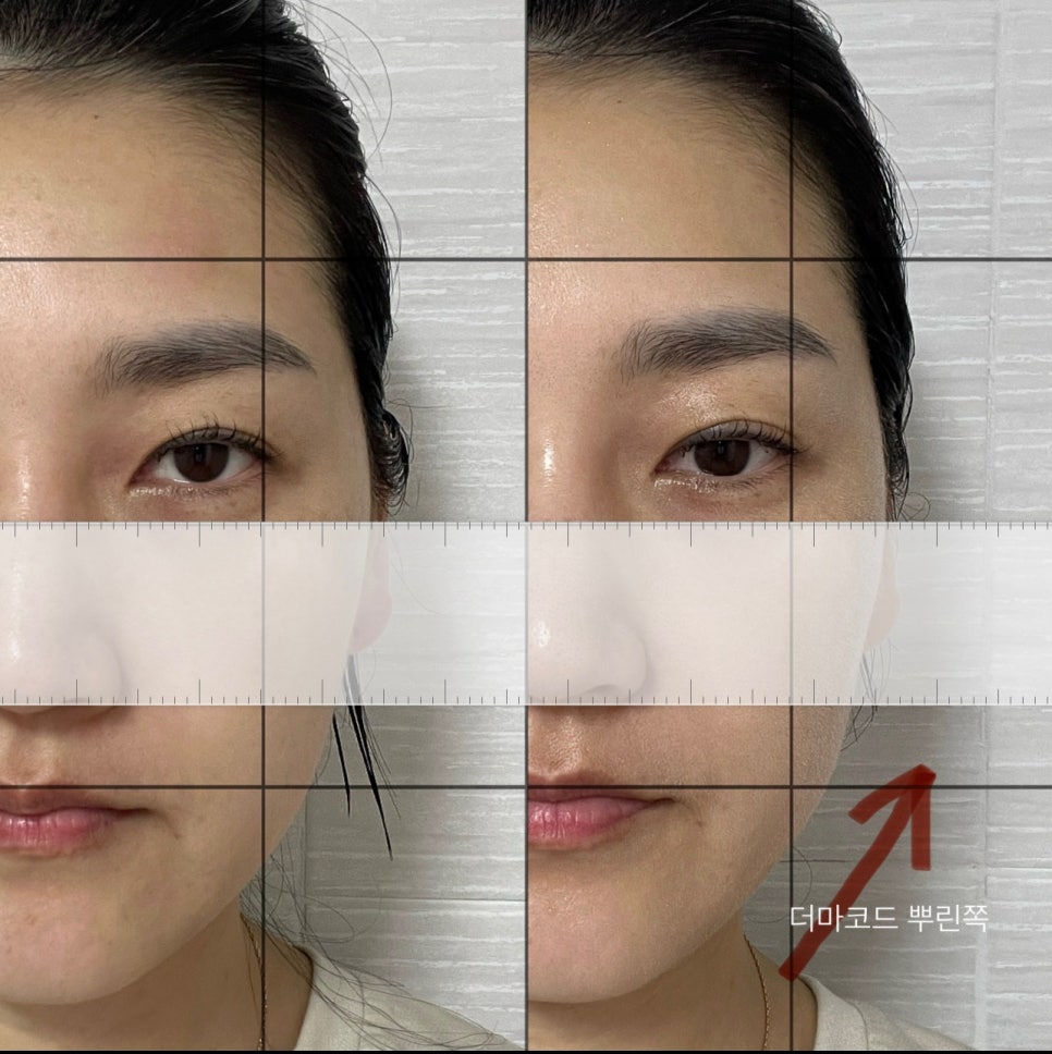 피닉스시스템 이미지
