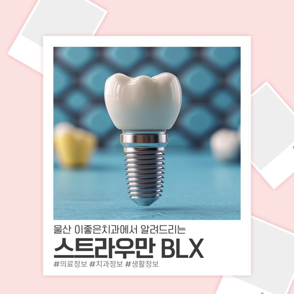 이-좋은 이미지