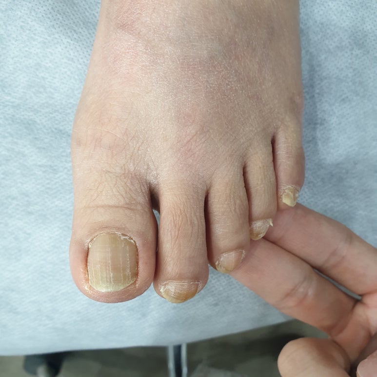 발라발라네일 이미지