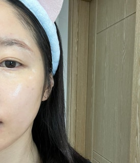 블로즈 이미지