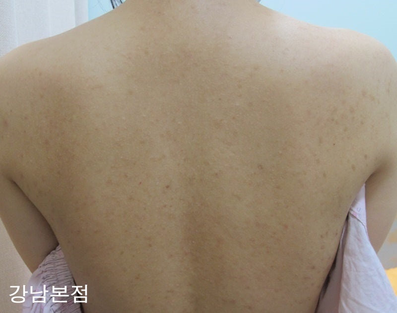 리유 이미지