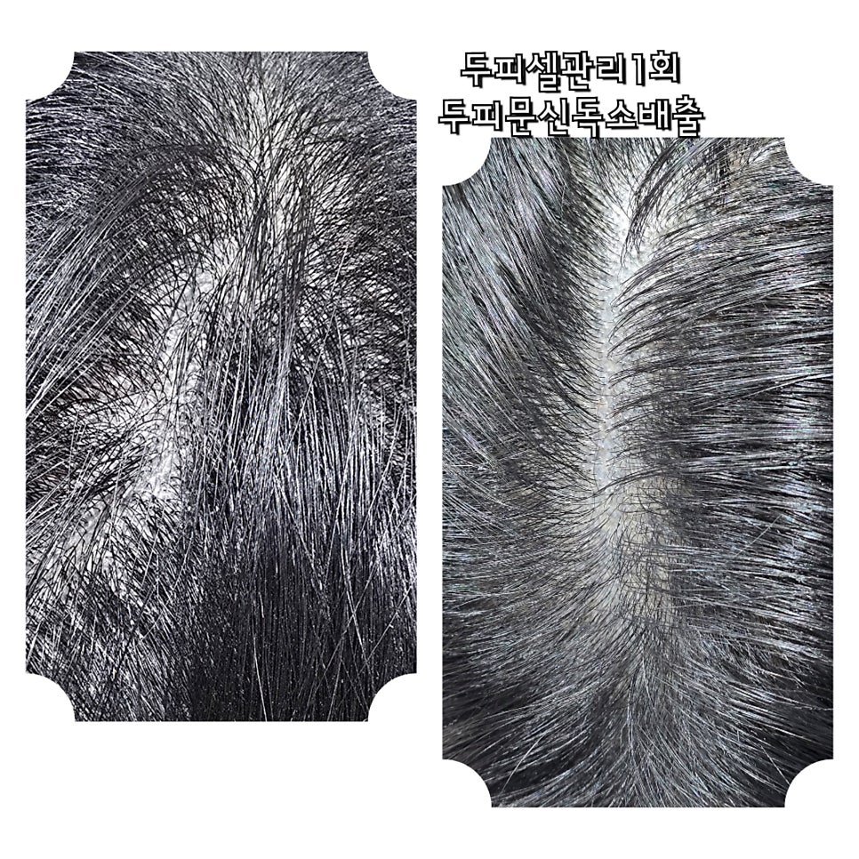 닥터시스 셀클럽 이미지