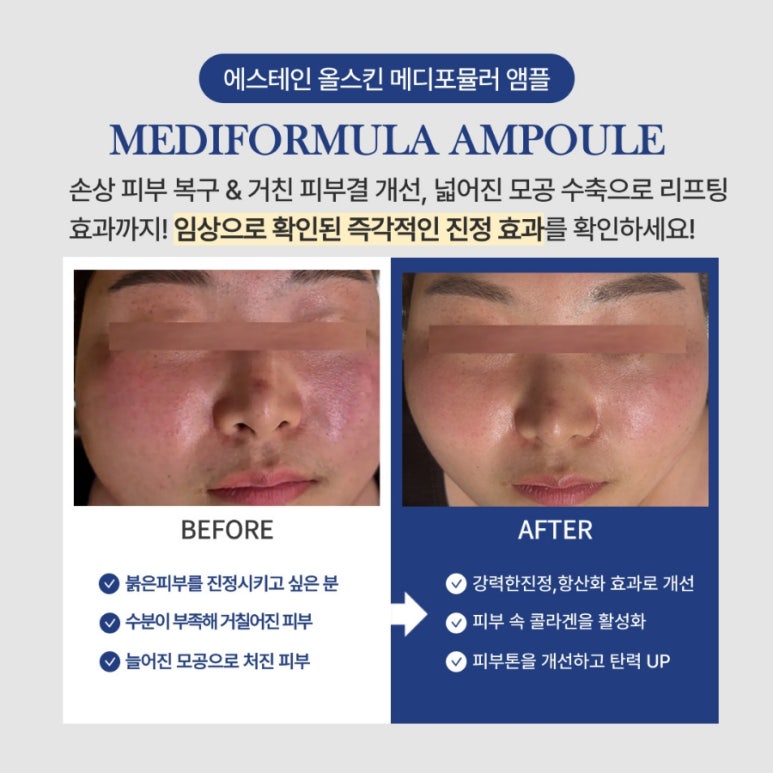 올메디 이미지