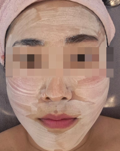 피부아지트(뉴페이스) 이미지