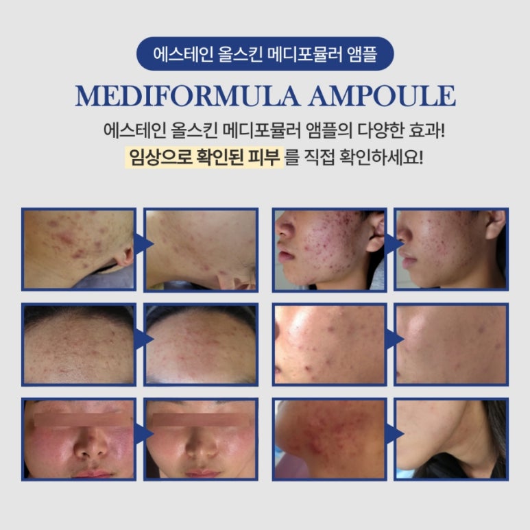 올메디 이미지