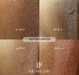 더나인뷰티 이미지
