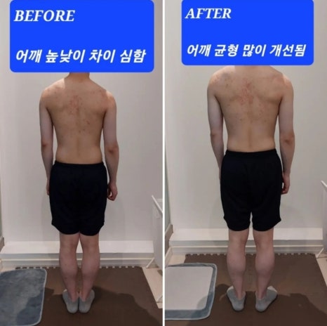 바로본신경외과 이미지