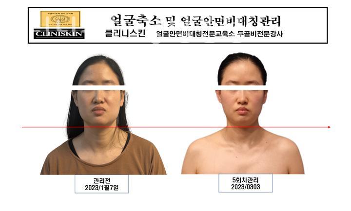 클리니스 이미지