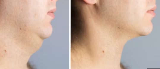히트성형외과의원 이미지