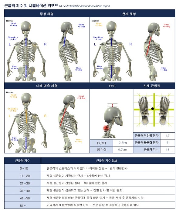 리픽스 이미지