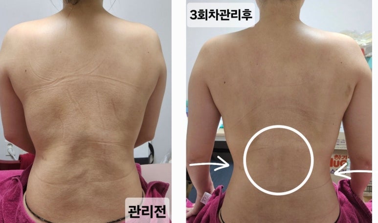 성남출장마사지 이미지